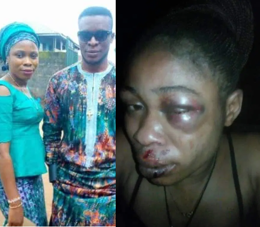 Ondo man beats wife for refusing to abort second pregnancy