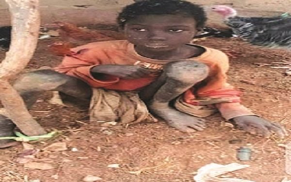 10-year-old chained for two years in Kebbi rescued.