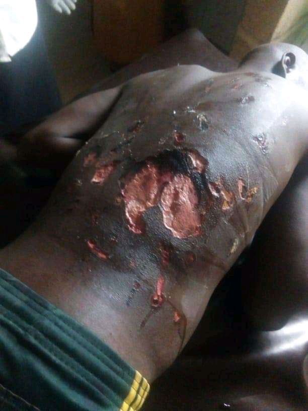 GRAPHIC PHOTOS : 14-year old Anas in critical condition after Nigerian soldiers stationed at Barkin Ladi in Plateau state brutally tortured him claiming ro ‘Teach him a lesson ‘.